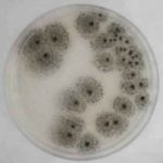 What Aspergillus Mold Looks Like